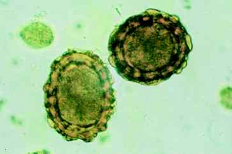 Spoelwormei 45-75 µm x 35-50 µm breed bestaat uit drie beschermende lagen, waardoor de overlevingskansen maximaal worden. Morfologisch is er geen verschil tussen het varkensspoelwormei en dit van de spoelworm bij de mens.
