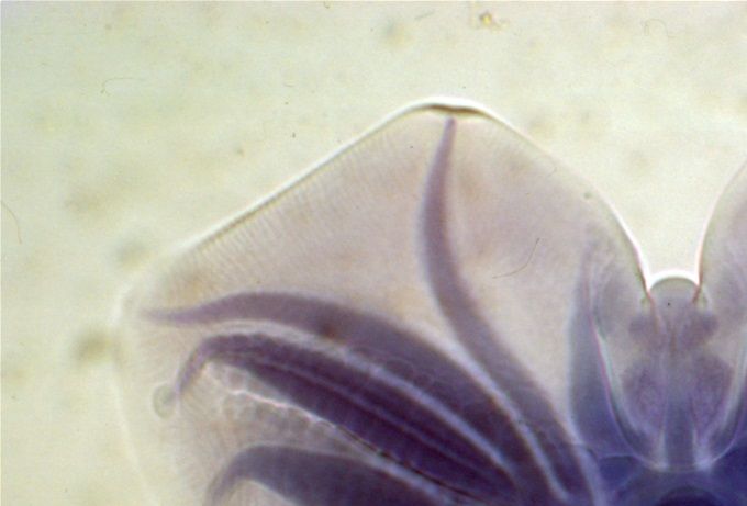 Wormstaart van de rode maagworm (Hyostrongylus rubidus) bij het varken