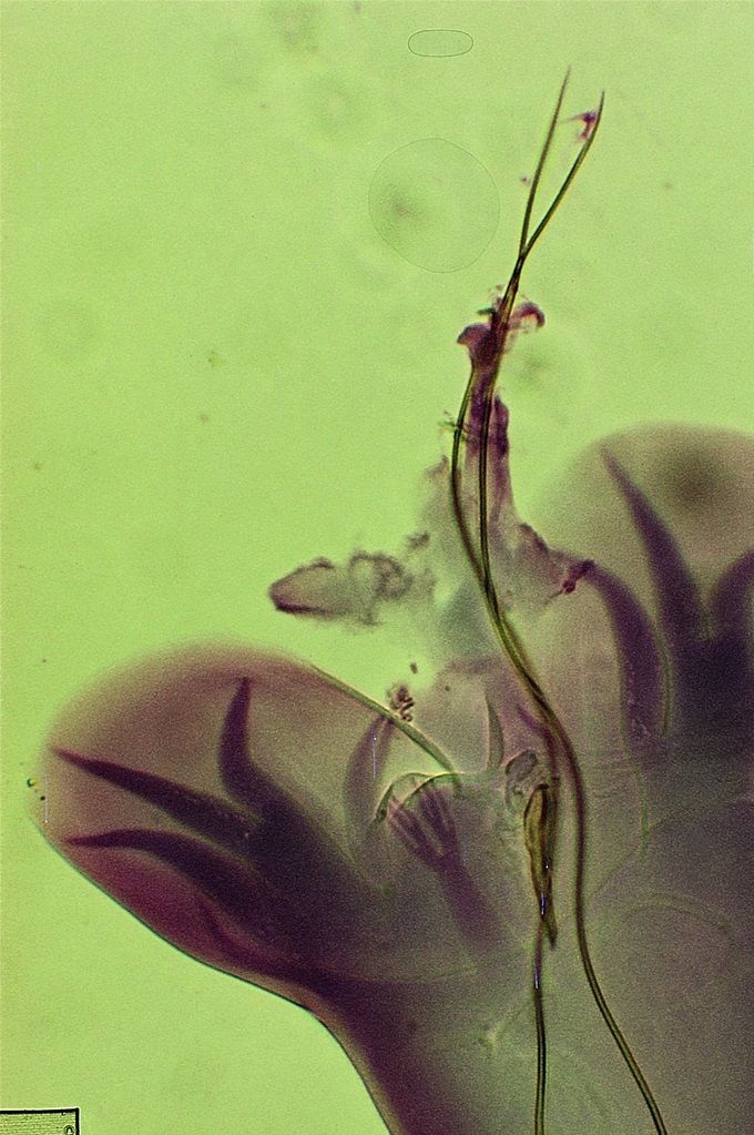 Wormstaart van de haakworm (Uncinaria stenocephala) bij de hond