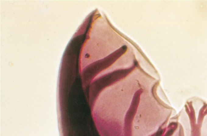 Wormstaart van de tropische haakworm bij de mens Ancylostoma braziliense