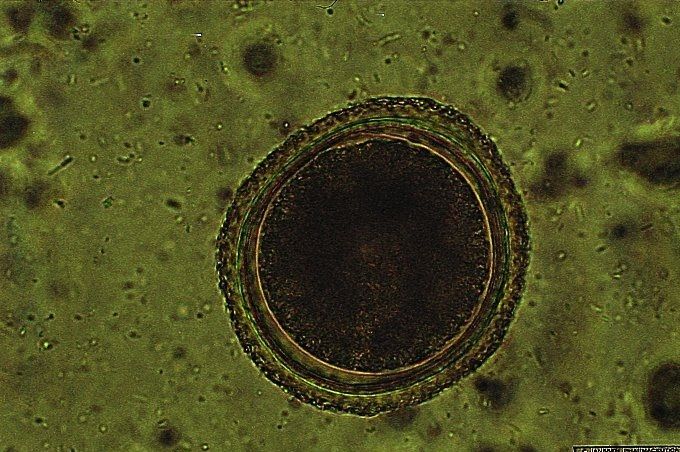 Niet besmettelijk Toxocara-ei