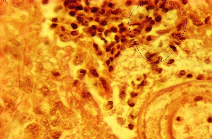 'Slapende larve' van de hondenspoelworm in het spierweefsel van de hond