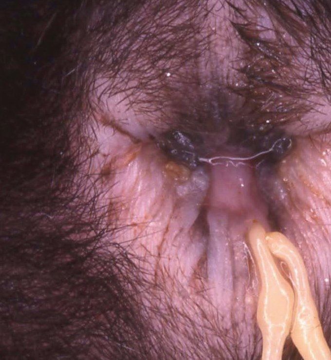 Segmenten van de vlooienlintworm komen uit de anus (foto Prof. Losson Luik)