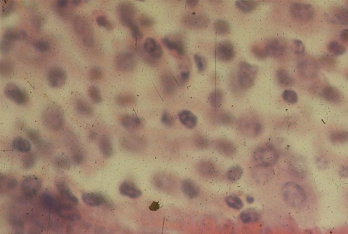 Omdat longwormlarven een intens contact hebben met het longweefsel is vaccinatie tegen longwormziekte mogelijk.