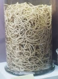De langste worm vindt men in de placenta van de potvis.