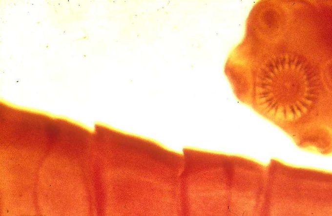 Segmenten van de varkenslintworm. Bovenaan de kop met hakenkrans.